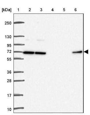 Western Blot: D-Glutamate Cyclase Antibody [NBP2-30590]