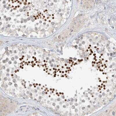 Immunohistochemistry-Paraffin: C2orf42 Antibody [NBP1-83644]
