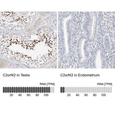 Immunohistochemistry-Paraffin: C2orf42 Antibody [NBP1-83644]