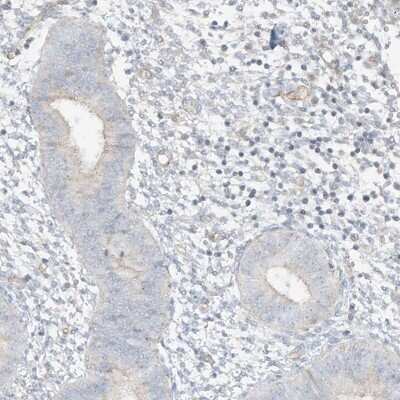 Immunohistochemistry-Paraffin: C2orf42 Antibody [NBP2-48620]
