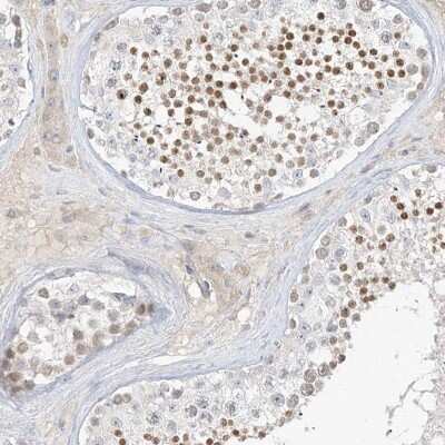 Immunohistochemistry-Paraffin: C2orf42 Antibody [NBP2-48620]