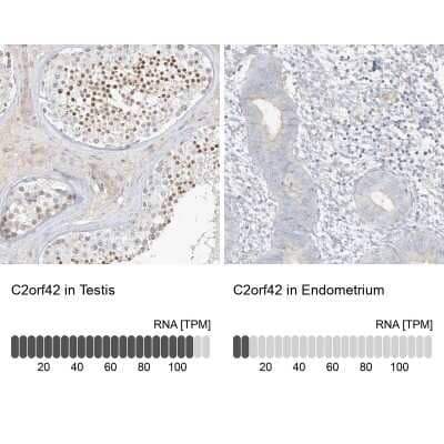 Immunohistochemistry-Paraffin: C2orf42 Antibody [NBP2-48620]