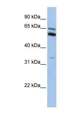 Western Blot: C2orf42 Antibody [NBP1-70466]