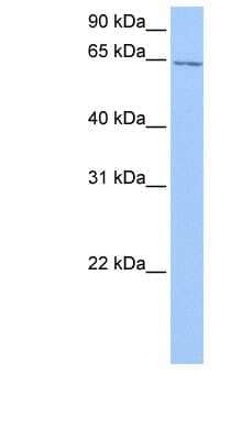 Western Blot: C2orf42 Antibody [NBP1-70467]