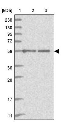 Western Blot: C2orf42 Antibody [NBP2-48620]