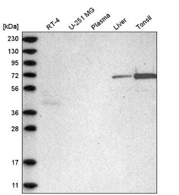 Western Blot: C2orf42 Antibody [NBP2-58034]