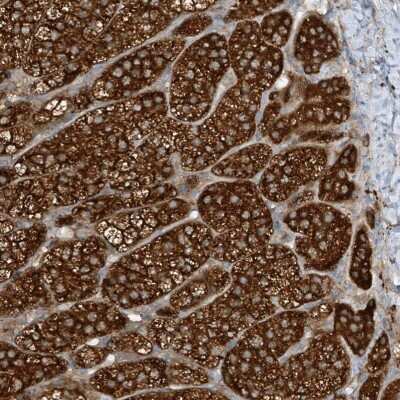 Immunohistochemistry: LDAH Antibody [NBP2-38219]