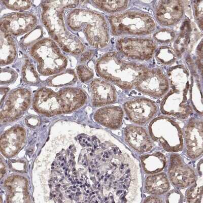 Immunohistochemistry: MAIP1 Antibody [NBP2-68933]