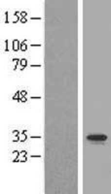 Western Blot: MAIP1 Overexpression Lysate [NBL1-08415]