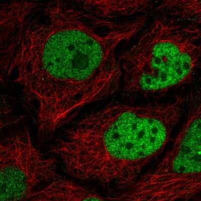 Immunocytochemistry/ Immunofluorescence: C2orf49 Antibody [NBP2-56365]