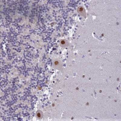 Immunohistochemistry-Paraffin: C2orf49 Antibody [NBP2-14404]