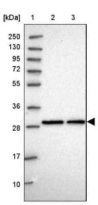 Western Blot: C2orf49 Antibody [NBP2-14404]