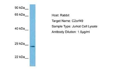 Western Blot: C2orf49 Antibody [NBP2-84555]