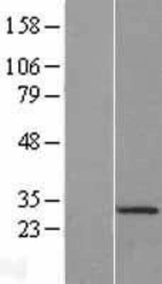 Western Blot: C2orf49 Overexpression Lysate [NBL1-08417]