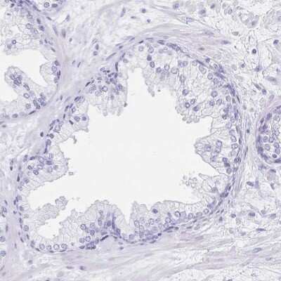 Immunohistochemistry-Paraffin: C2orf50 Antibody [NBP2-32374]