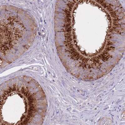 Immunohistochemistry-Paraffin: C2orf55 Antibody [NBP2-14405]