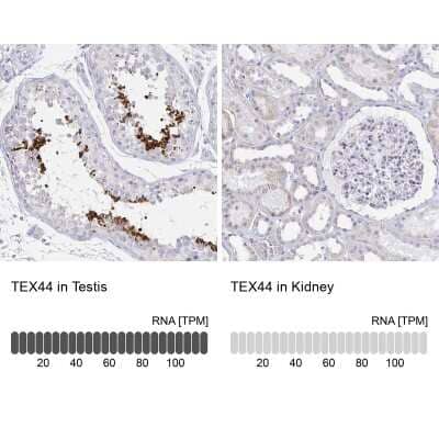 Immunohistochemistry-Paraffin: TEX44 Antibody [NBP2-49226]