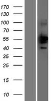 Western Blot: TEX44 Overexpression Lysate [NBP2-05329]