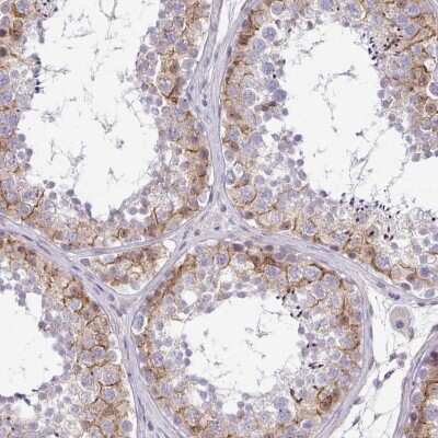 Immunohistochemistry-Paraffin: STPG4 Antibody [NBP2-38676]