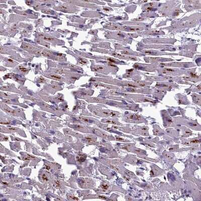 Immunohistochemistry-Paraffin: CATIP Antibody [NBP1-91729]