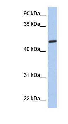 Western Blot: CATIP Antibody [NBP1-56807]