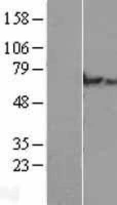 Western Blot: CLHC1 Overexpression Lysate [NBL1-08425]