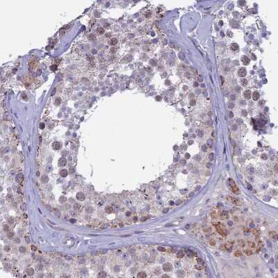 Immunohistochemistry-Paraffin: M1AP Antibody [NBP1-94091]