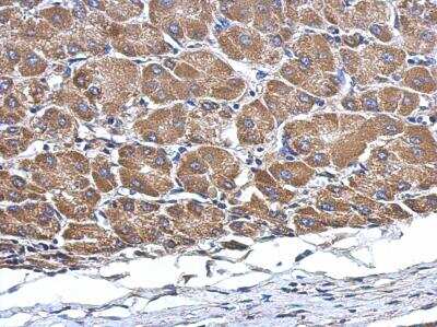 Immunohistochemistry-Paraffin: M1AP Antibody [NBP2-15648]