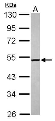 Western Blot: M1AP Antibody [NBP2-15648]