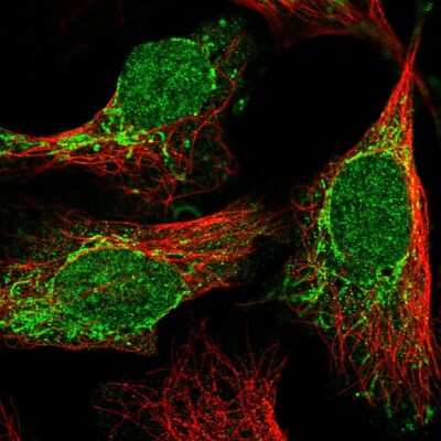 Immunocytochemistry/ Immunofluorescence: C2orf68 Antibody [NBP2-31905]