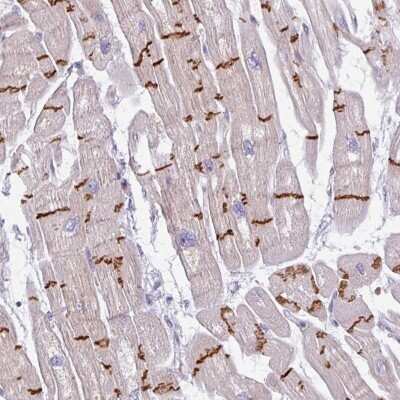 Immunohistochemistry: C2orf68 Antibody [NBP2-31905]