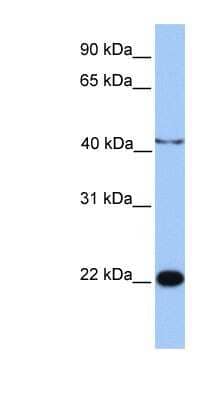 Western Blot: C2orf68 Antibody [NBP1-70469]