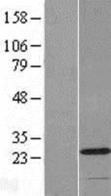 Western Blot: C2orf68 Overexpression Lysate [NBP2-08726]