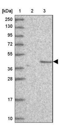 Western Blot: C2orf69 Antibody [NBP1-91731]