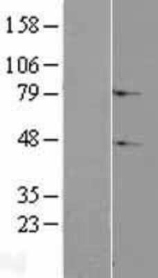 Western Blot: C2orf69 Overexpression Lysate [NBL1-08429]