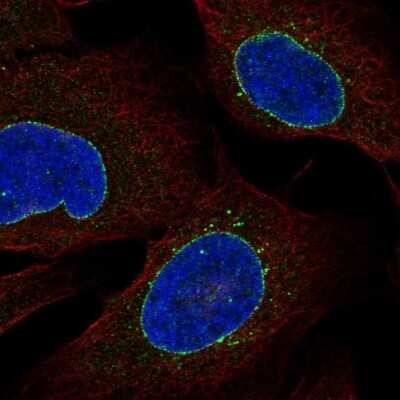 Immunocytochemistry/ Immunofluorescence: C2orf70 Antibody [NBP2-32360]