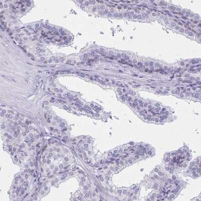 Immunohistochemistry-Paraffin: C2orf70 Antibody [NBP2-32360]