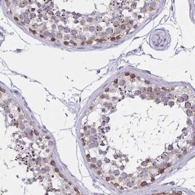 Immunohistochemistry-Paraffin: C2orf70 Antibody [NBP2-32360]