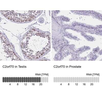 Immunohistochemistry-Paraffin: C2orf70 Antibody [NBP2-32360]