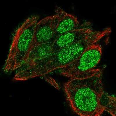 Immunocytochemistry/ Immunofluorescence: C2orf72 Antibody [NBP1-93551]