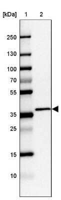 Western Blot: C2orf72 Antibody [NBP1-93551]