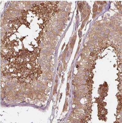 Immunohistochemistry: C2orf73 Antibody [NBP2-30816]