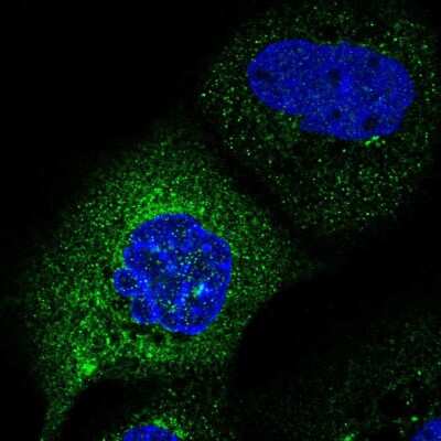 Immunocytochemistry/ Immunofluorescence: C2orf76 Antibody [NBP2-56729]