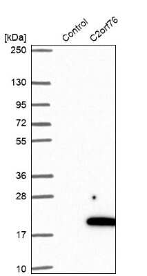 Western Blot: C2orf76 Antibody [NBP1-91732]