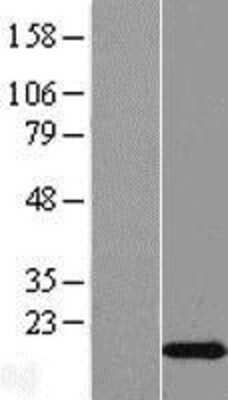 Western Blot: C2orf76 Overexpression Lysate [NBL1-12575]