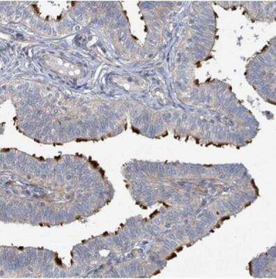 Immunohistochemistry: CCDC173 Antibody [NBP2-30912]