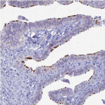 Immunohistochemistry: CCDC173 Antibody [NBP2-30925]