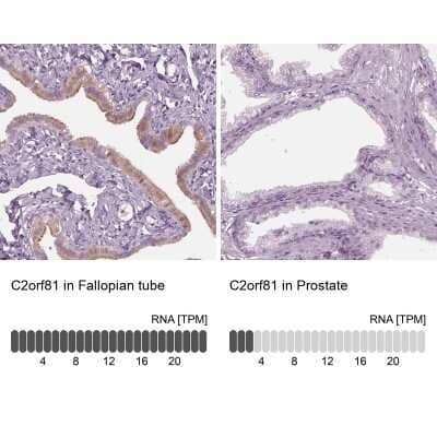 Immunohistochemistry-Paraffin: C2orf81 Antibody [NBP2-58395]