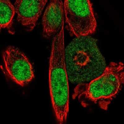 Immunocytochemistry/ Immunofluorescence: SNORC Antibody [NBP2-30862]