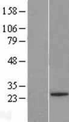 Western Blot: FAM228A Overexpression Lysate [NBL1-10762]